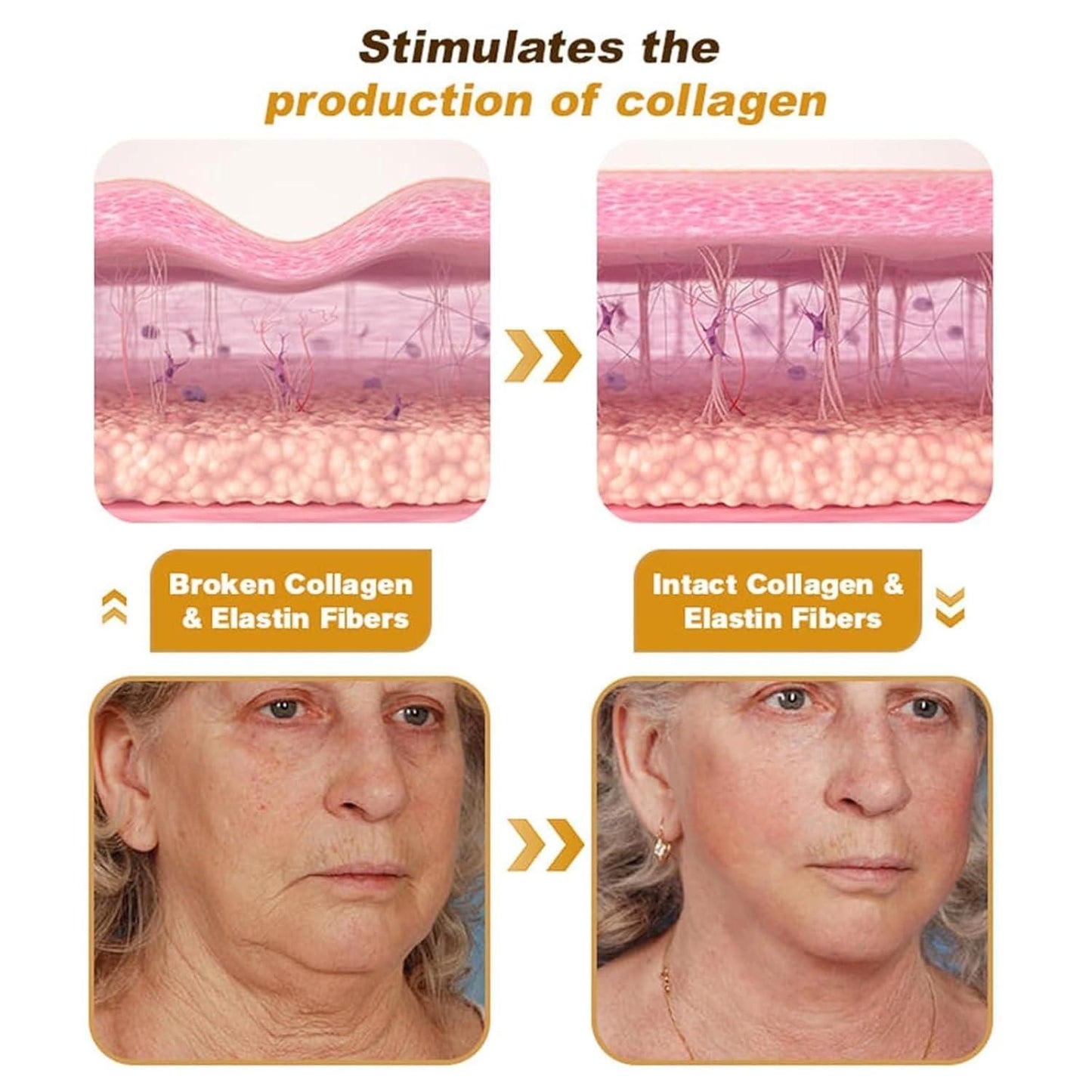BeeTox® - Bee Venom Wrinkle Repair Cream (Buy 1 Get 1 Free)