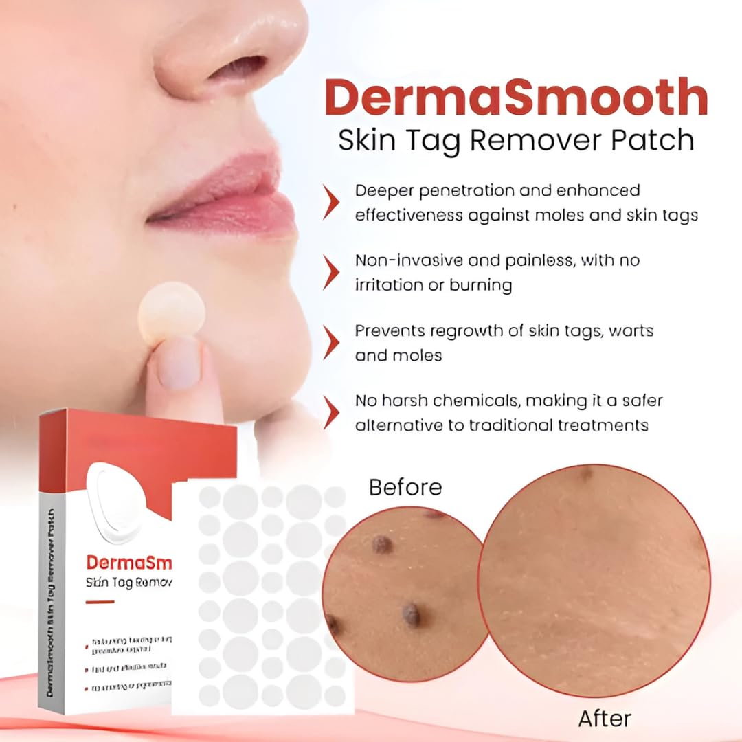 (BUY 1 GET 2) TagAway® - Premium Skin Tag Remover Patches (Pack of 144 Patches)