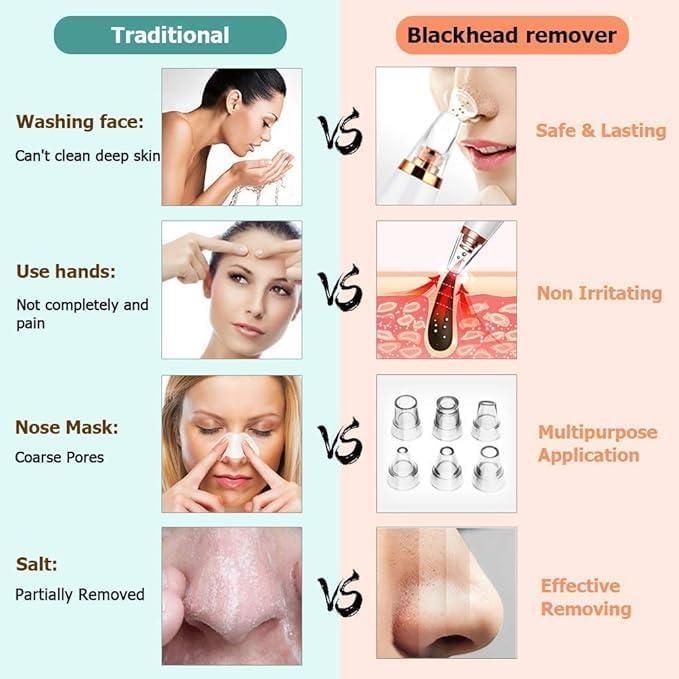 PorePerfect® - 6 in 1 Multifunctional Blackhead Remover Tool