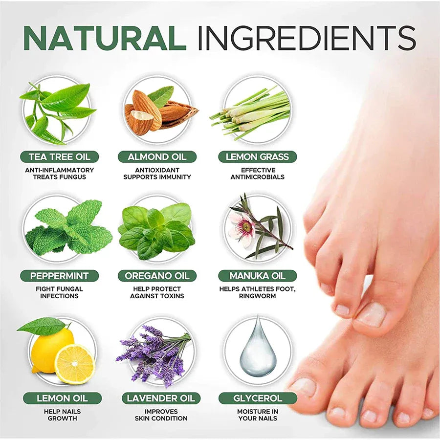 (BUY 1 GET 1 FREE) Redapple Anti-Paronychia Relief Oil