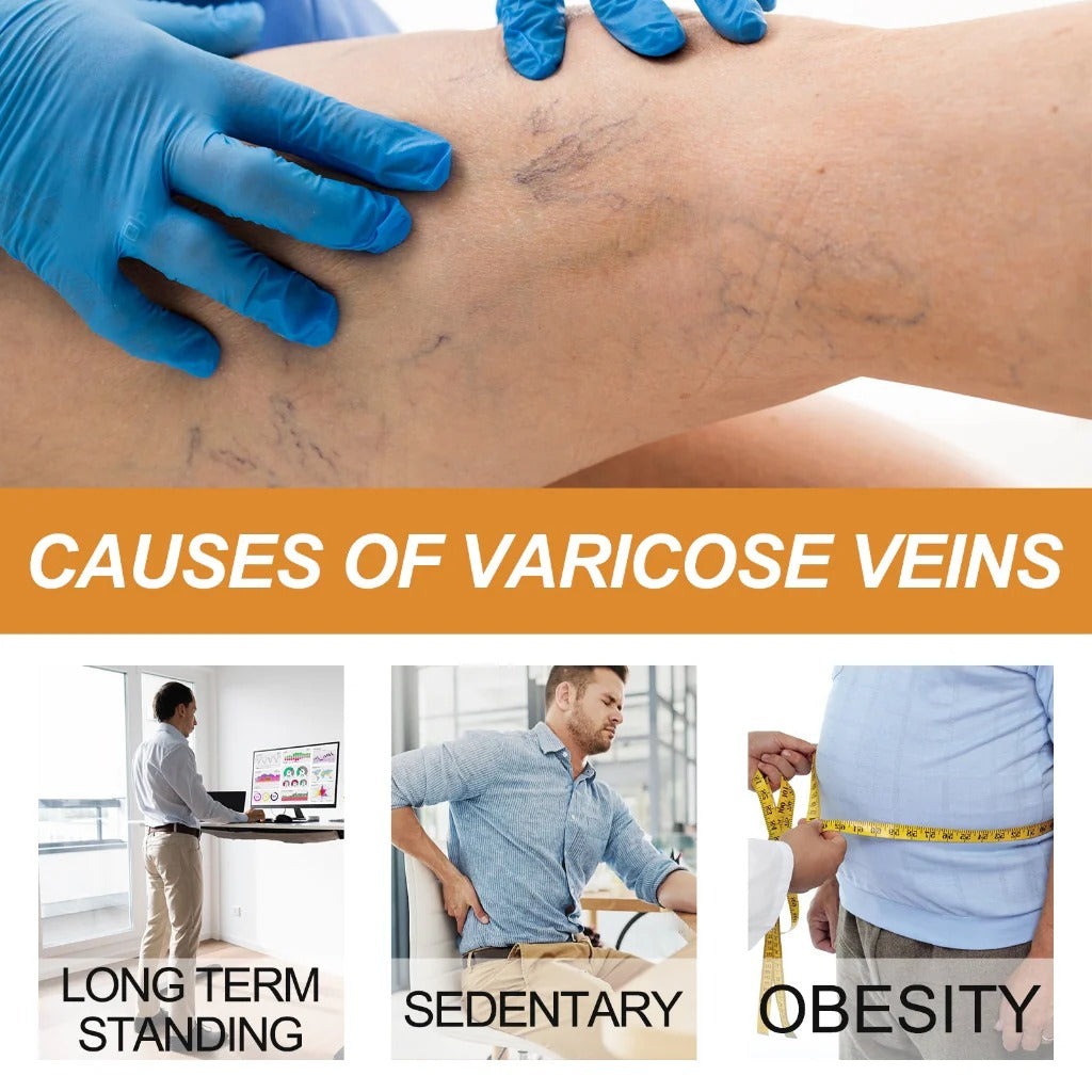 (BUY 1 GET 1 FREE) VeinGuard® - Varicose Vein Relief Spray