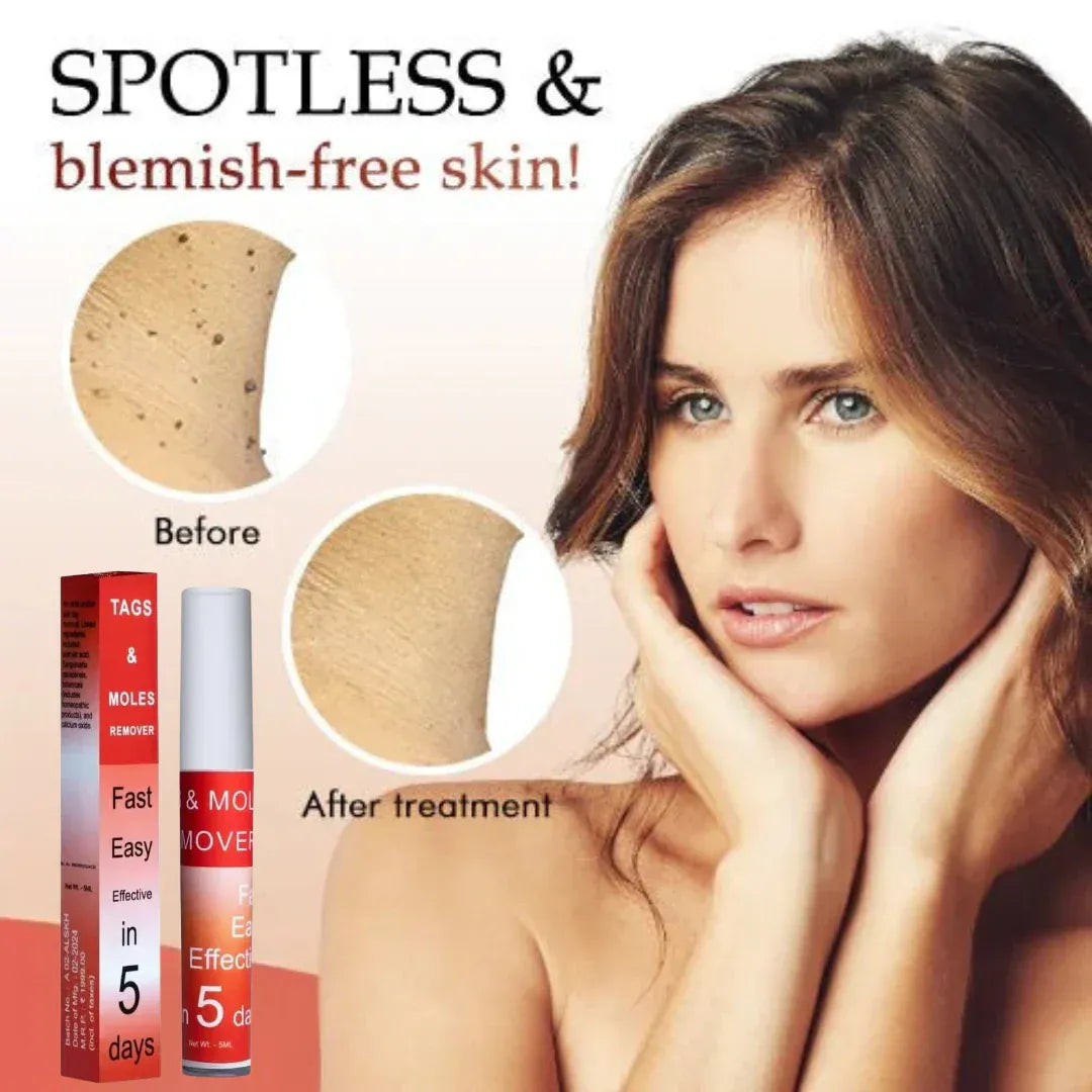 (BUY 1 GET 1 FREE) SpotErase® - Painless Skin Tag & Mole Remover