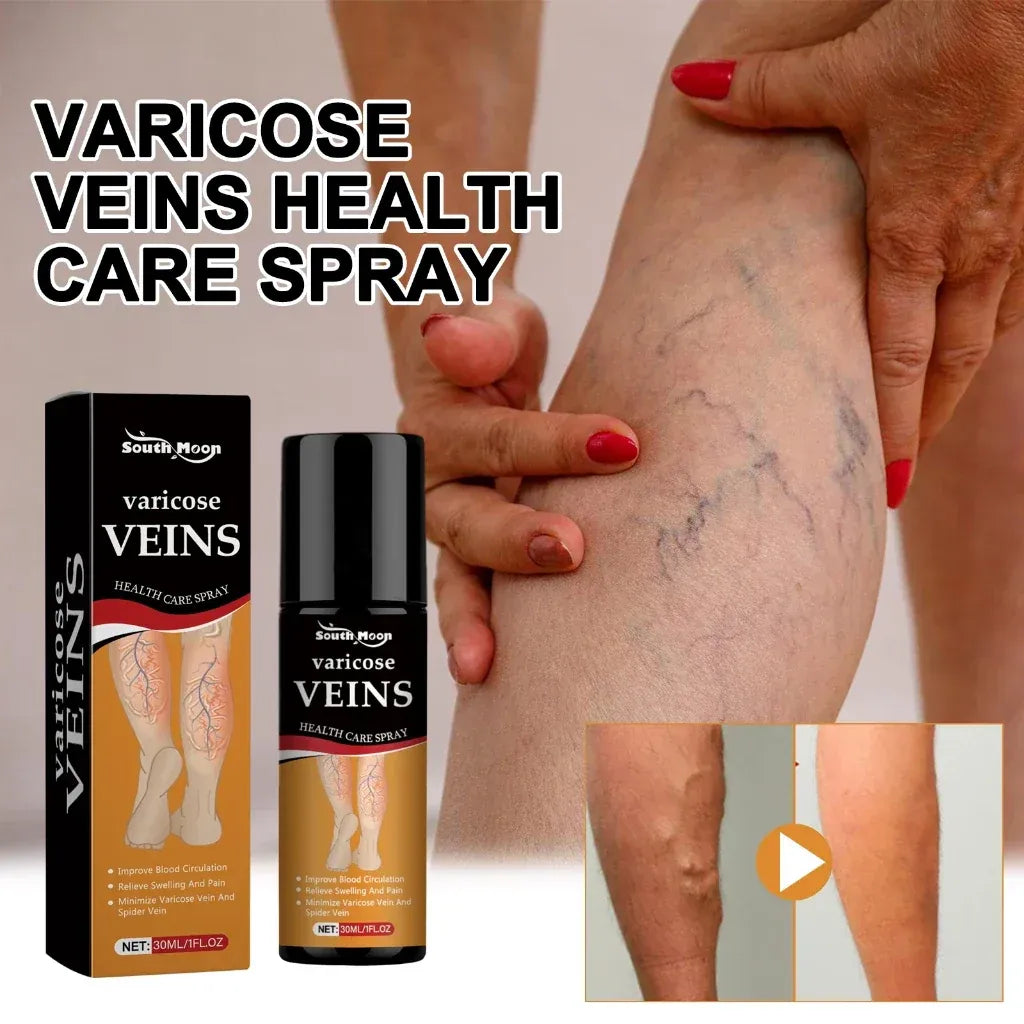 (BUY 1 GET 1 FREE) VeinGuard® - Varicose Vein Relief Spray