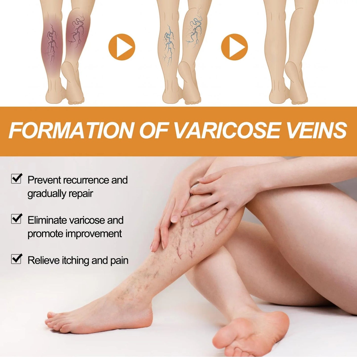 (BUY 1 GET 1 FREE) VeinGuard® - Varicose Vein Relief Spray