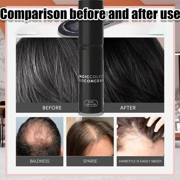 (BUY 1 GET 1 FREE) Hairloom® - Scalp Concealer for Fuller, Natural-Looking Hair