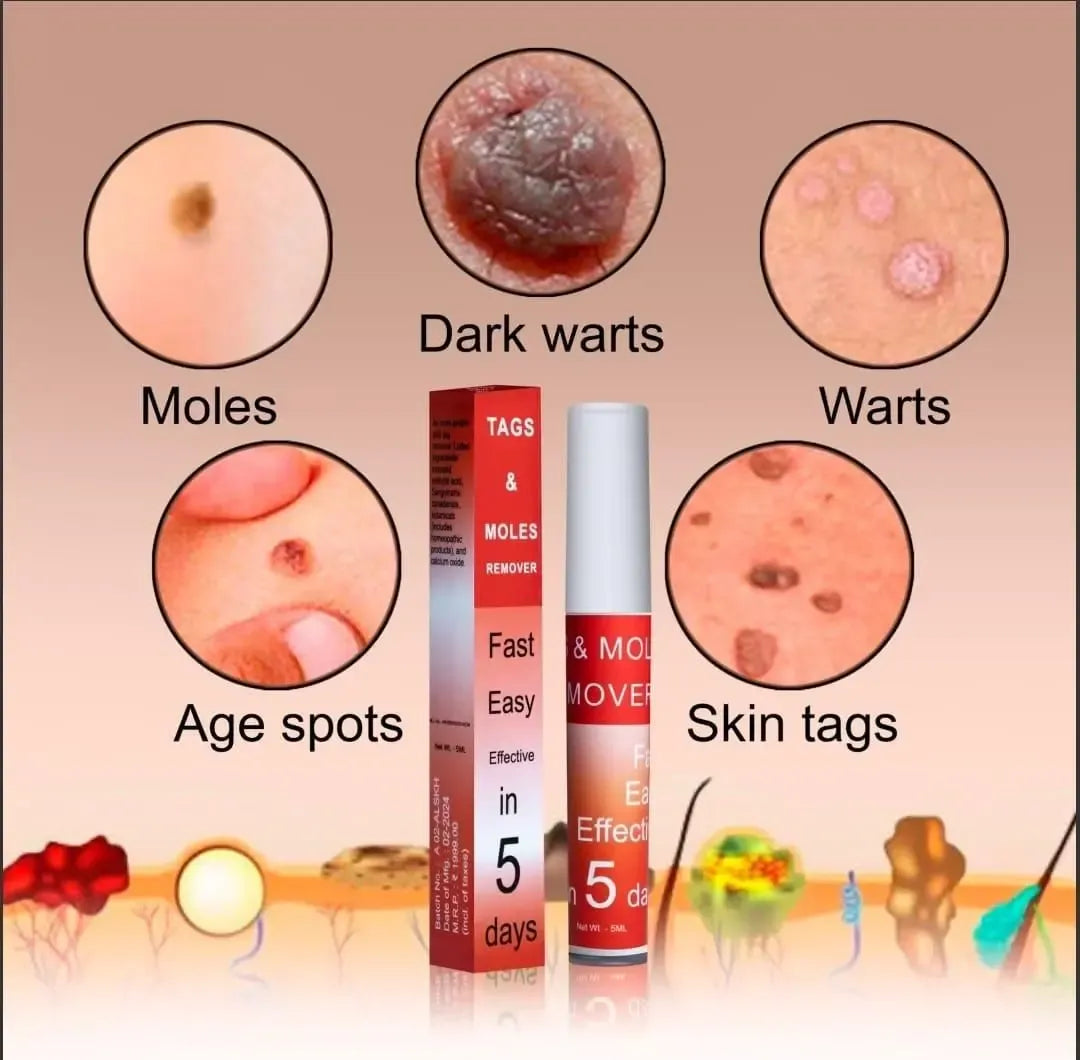(BUY 1 GET 1 FREE) SpotErase® - Painless Skin Tag & Mole Remover