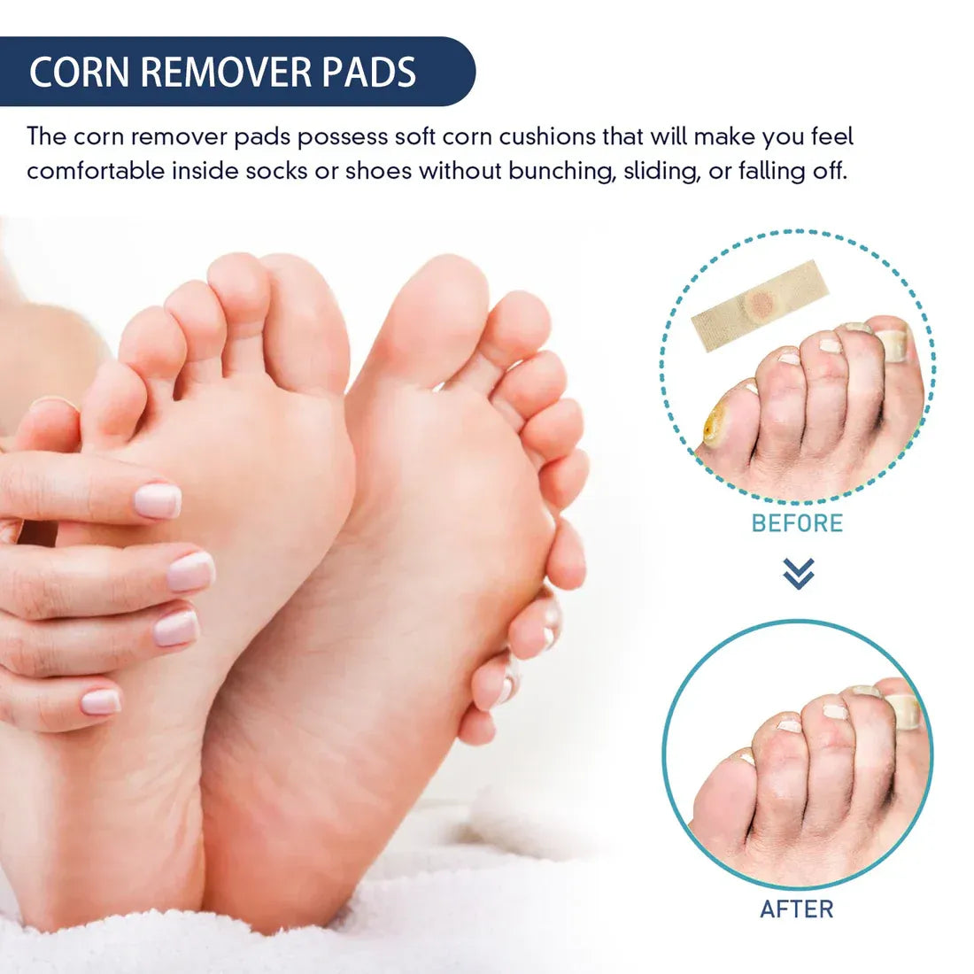 (BUY 1 GET 1 FREE) Velveto® - Corn Remover Pads (Pack of 24)
