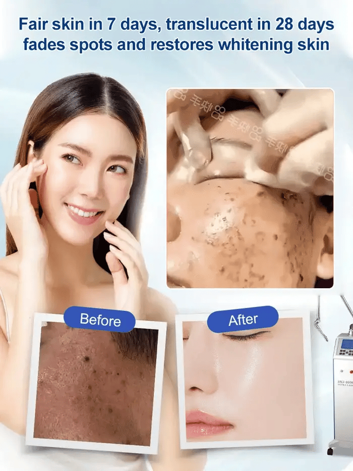 Spot Fading Urea Cream – Deep Moisture & Nourishment (Buy 1 Get 1 Free)
