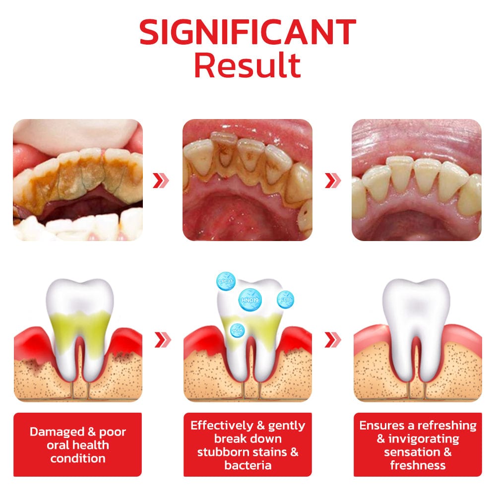 Original™ SP4 Ultra Teeth Whitening Toothpaste (Buy 1 Get 1 Free)