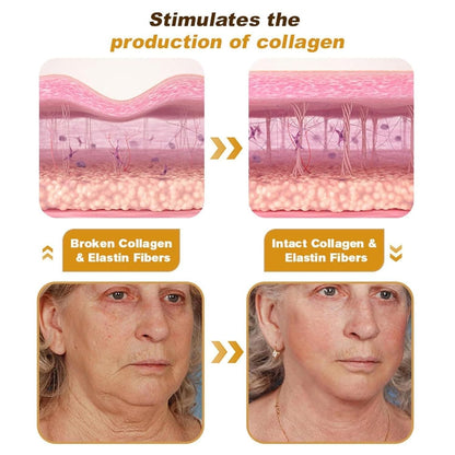BeeTox® - Bee Venom Wrinkle Repair Cream (Buy 1 Get 1 Free)