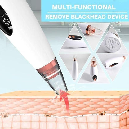 PorePerfect® - 6 in 1 Multifunctional Blackhead Remover Tool