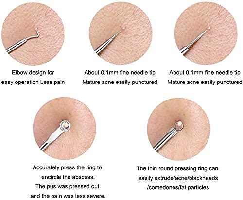 Porex® - Stainless Steel Blackhead Remover Extractor Tool Kit