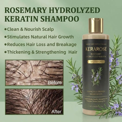 (BUY 1 GET 1 FREE) Kerarose® - Magic Rosemary Hair Growth Shampoo