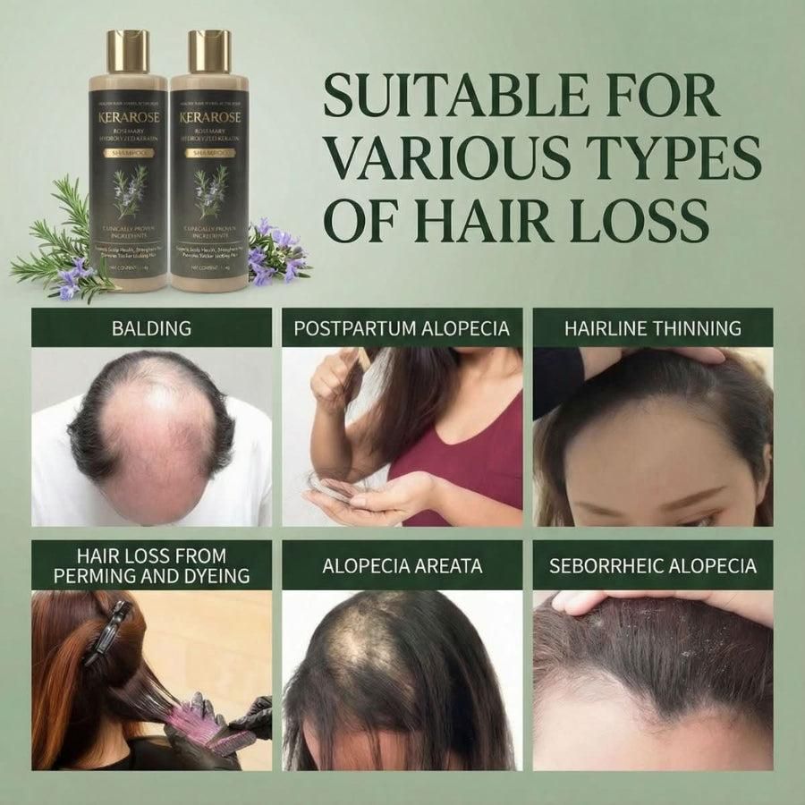 (BUY 1 GET 1 FREE) Kerarose® - Magic Rosemary Hair Growth Shampoo