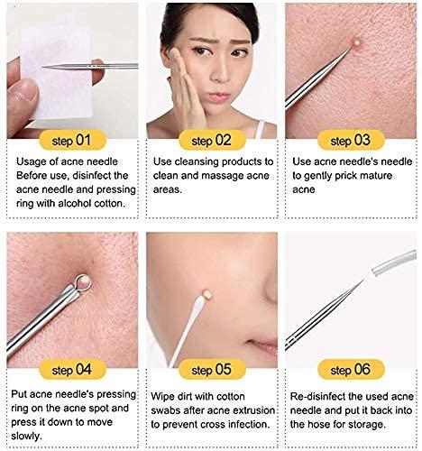 Porex® - Stainless Steel Blackhead Remover Extractor Tool Kit