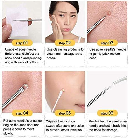 Porex® - Stainless Steel Blackhead Remover Extractor Tool Kit