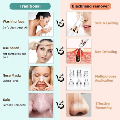 PorePerfect® - 6 in 1 Multifunctional Blackhead Remover Tool