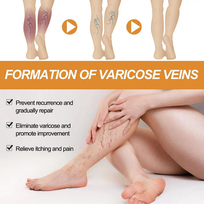 (BUY 1 GET 1 FREE) VeinGuard® - Varicose Vein Relief Spray