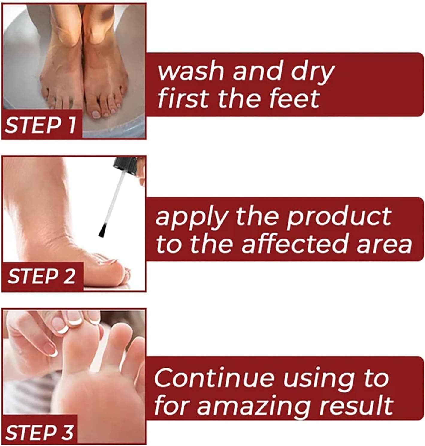 CornEase® - Advanced Feet Corn Removal Serum