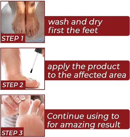 CornEase® - Advanced Feet Corn Removal Serum