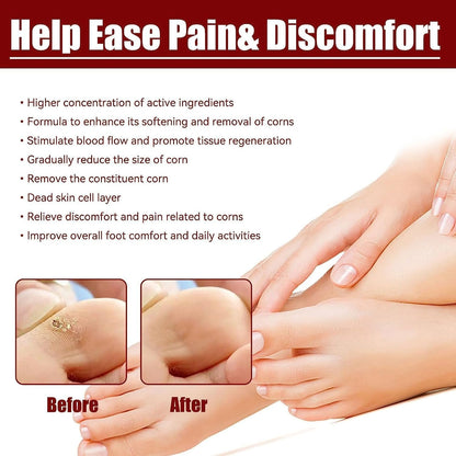 CornEase® - Advanced Feet Corn Removal Serum