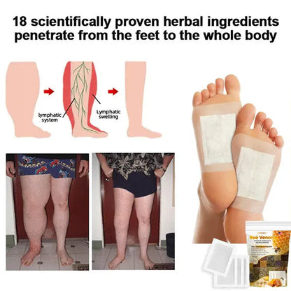 (BUY 1 GET 1 FREE) Bee Venom Lymphatic Drainage & Slimming Foot Patches (60 Patches)
