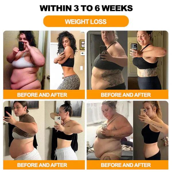 (BUY 1 GET 1 FREE) Bee Venom Lymphatic Drainage & Slimming Foot Patches (60 Patches)