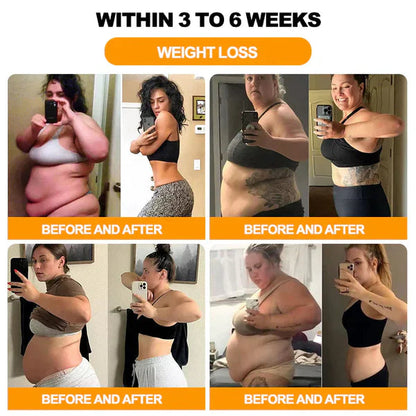 (BUY 1 GET 1 FREE) Bee Venom Lymphatic Drainage & Slimming Foot Patches (60 Patches)